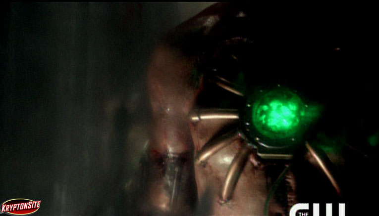 Smallville Metallo